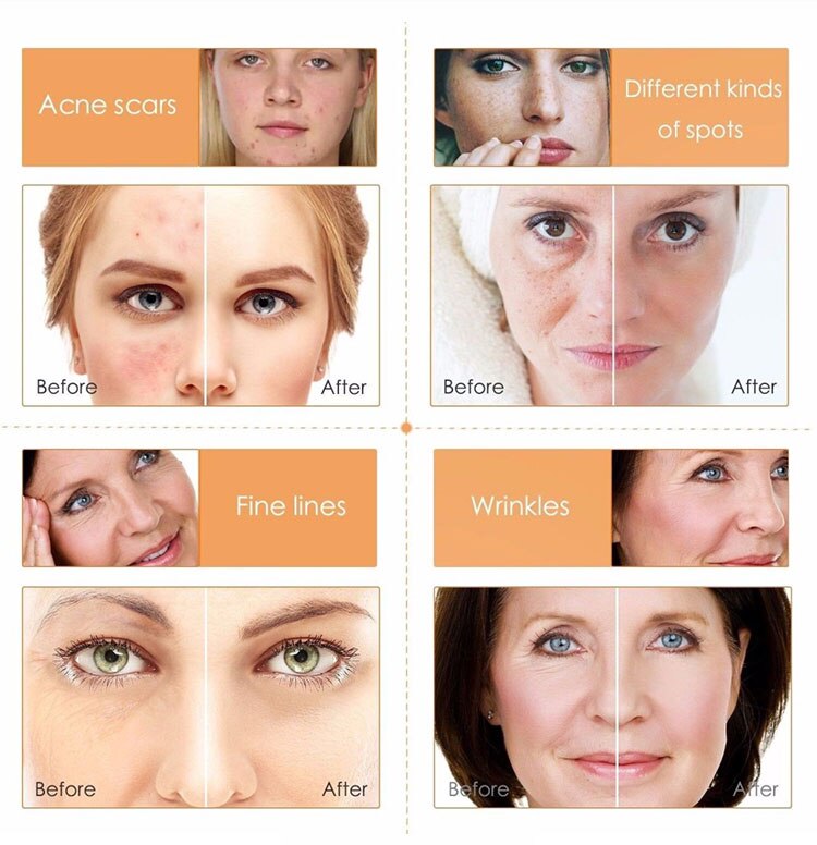 Luury Essential Oil for Face 5 pcs Set