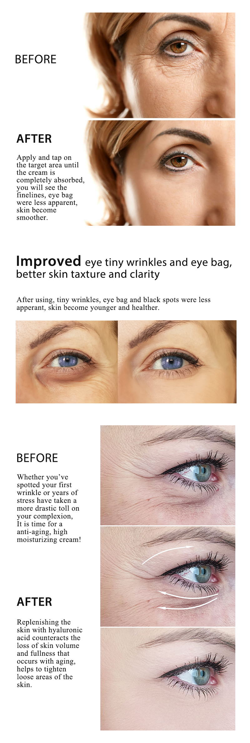 Wrinkles Removing Antioxidante Day Cream for Face