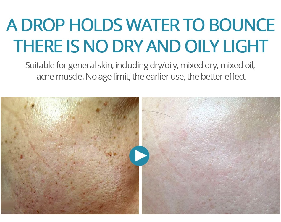 Hyaluronic Acid Shrink Pore Face Serum Hyaluronic Acid Shrink Pore Face Serum